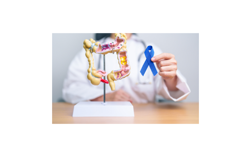 Why you should spring clean your colon